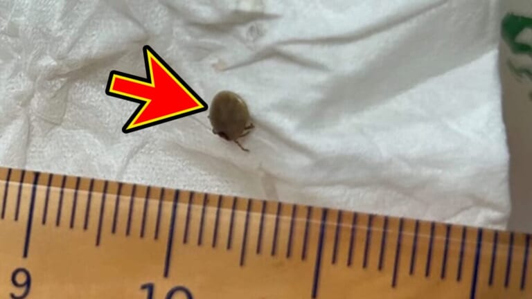 【死亡例もある危険生物】取材は一時中断、病院で麻酔して切開。見知らぬ地で起こったキツすぎる洗礼