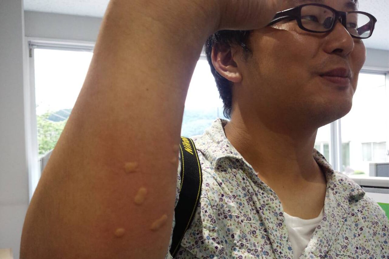 ｜「どういう仕組みなの？」虫が活発になる秋→「痛い目を見る前に」使いたいアイテム。「世界各国で愛用されています」