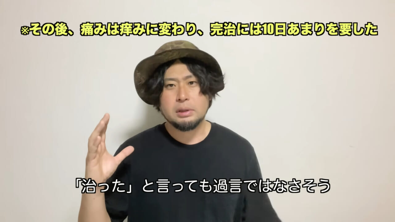 ｜死亡例もある世界最強の『毒魚』に刺されてみた結果→「トンカチで骨を殴られたみたい」身体を張って毒の威力を大検証。「絶対にマネしないで」