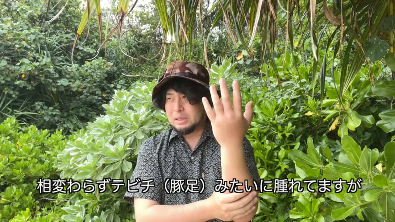 ｜死亡例もある世界最強の『毒魚』に刺されてみた結果→「トンカチで骨を殴られたみたい」身体を張って毒の威力を大検証。「絶対にマネしないで」