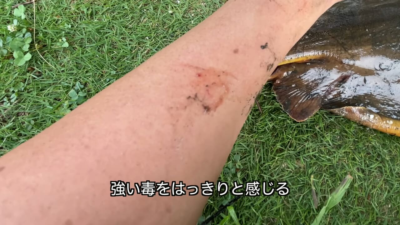 |「うぉー、痛ってえええ」東京湾にも生息する『身近な危険生物』に刺されたらこうなった。「この黒いネバネバが“毒液”です」