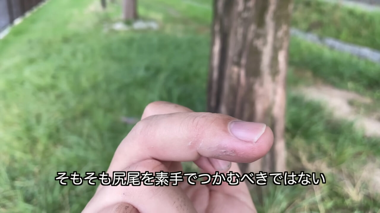 ｜「うぉー、痛ってえええ」東京湾にも生息する『身近な危険生物』に刺されたらこうなった。「この黒いネバネバが“毒液”です」