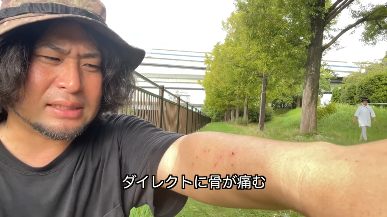 |「うぉー、痛ってえええ」東京湾にも生息する『身近な危険生物』に刺されたらこうなった。「この黒いネバネバが“毒液”です」