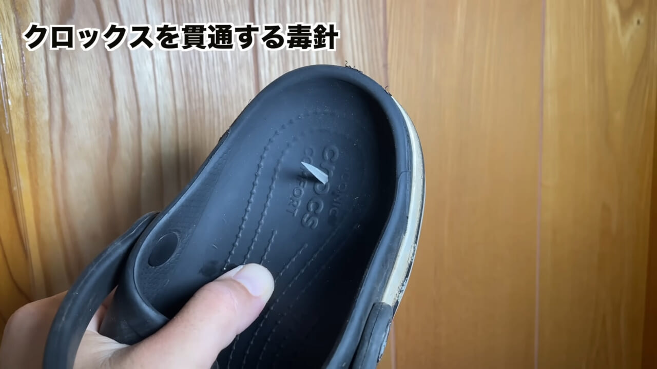 |「うぉー、痛ってえええ」東京湾にも生息する『身近な危険生物』に刺されたらこうなった。「この黒いネバネバが“毒液”です」