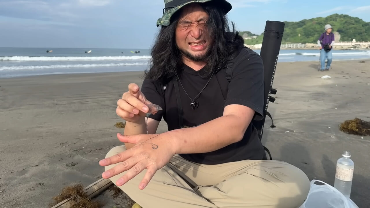 ｜「くぅーっ、うわぁ」海水浴場によく出現”猛毒クラゲ”に刺されてみた。目を背けたくなるひどい症例もあります。