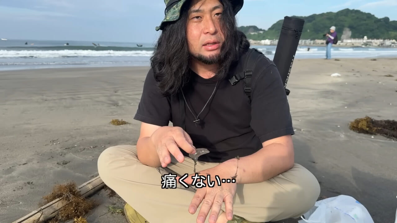 |「くぅーっ、うわぁ」海水浴場によく出現”猛毒クラゲ”に刺されてみた。目を背けたくなるひどい症例もあります。