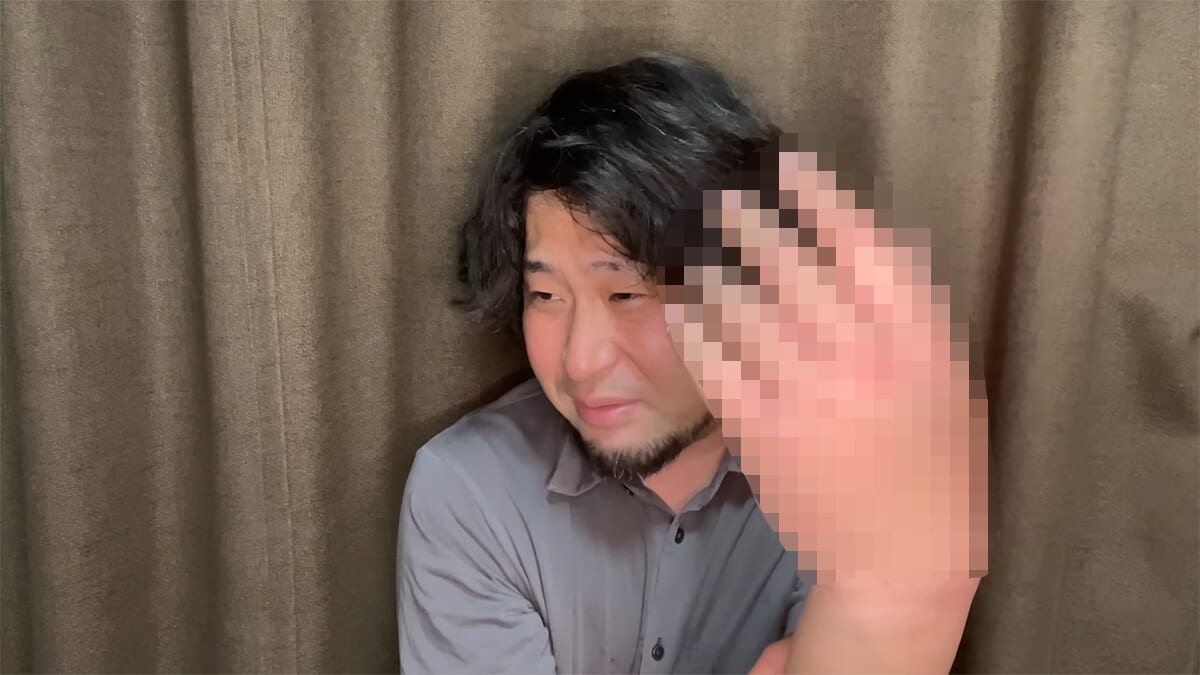 ｜死亡例もある世界最強の『毒魚』に刺されてみた結果→「トンカチで骨を殴られたみたい」身体を張って毒の威力を大検証。「絶対にマネしないで」