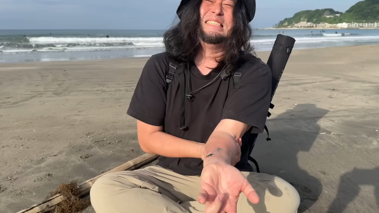 |「くぅーっ、うわぁ」海水浴場によく出現”猛毒クラゲ”に刺されてみた。目を背けたくなるひどい症例もあります。
