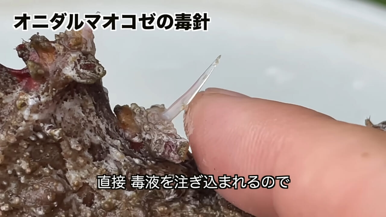 |「うぉー、痛ってえええ」東京湾にも生息する『身近な危険生物』に刺されたらこうなった。「この黒いネバネバが“毒液”です」