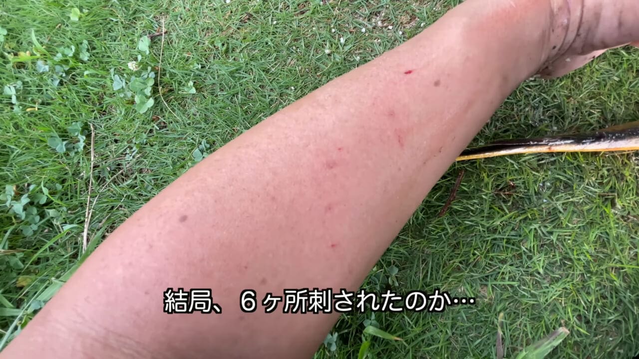 |「うぉー、痛ってえええ」東京湾にも生息する『身近な危険生物』に刺されたらこうなった。「この黒いネバネバが“毒液”です」